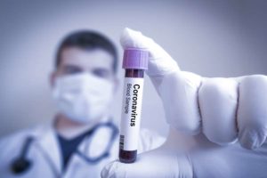 Coronavirus Warstein Sars-Cov-2 Nahrungsergänzungsmittel Supplemente Immunsystem